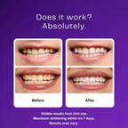 Color-Correct Whitening Strips