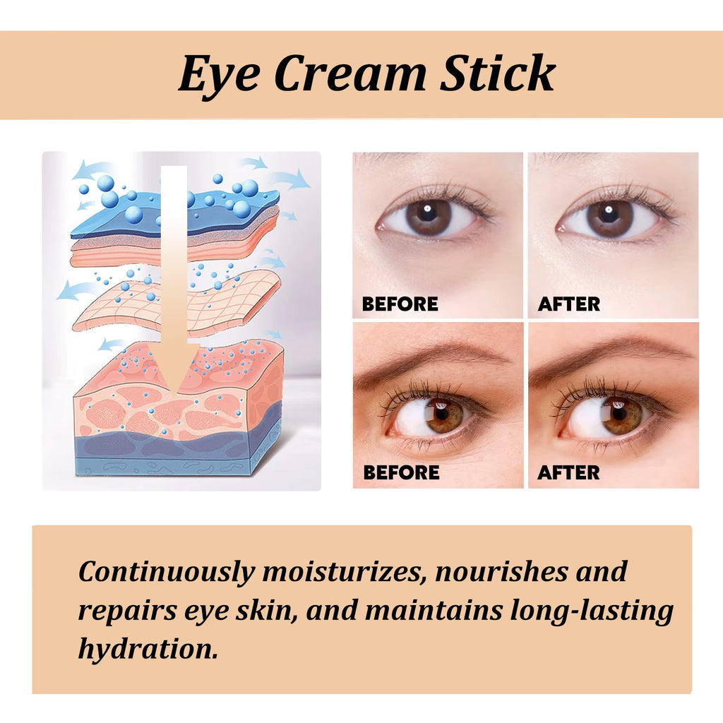 Snail Collagen Eye Stick: Erase Wrinkles, Bags & Circles!