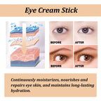 Snail Collagen Eye Stick: Erase Wrinkles, Bags & Circles!